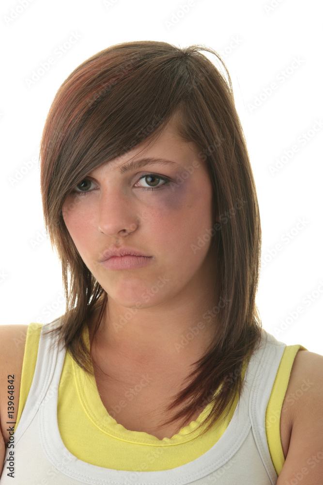 Abused teenage girl Abused teenage girl