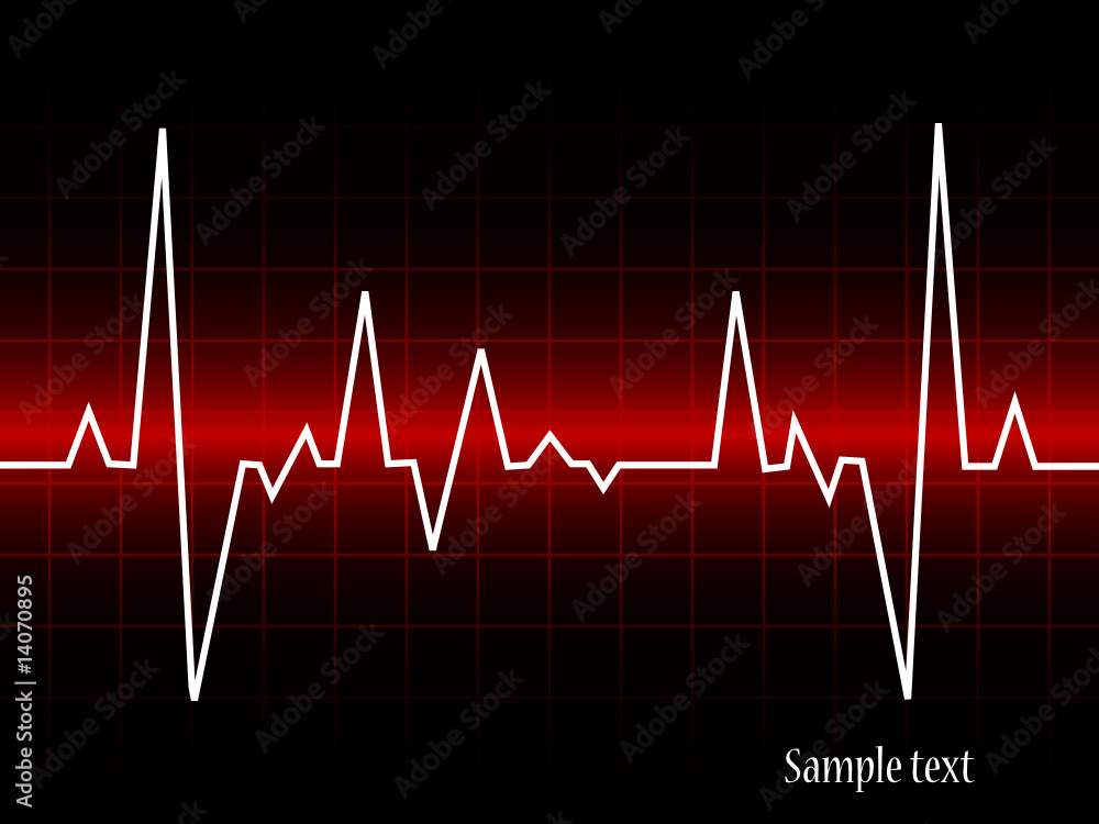electrocardiogram- vector illustration