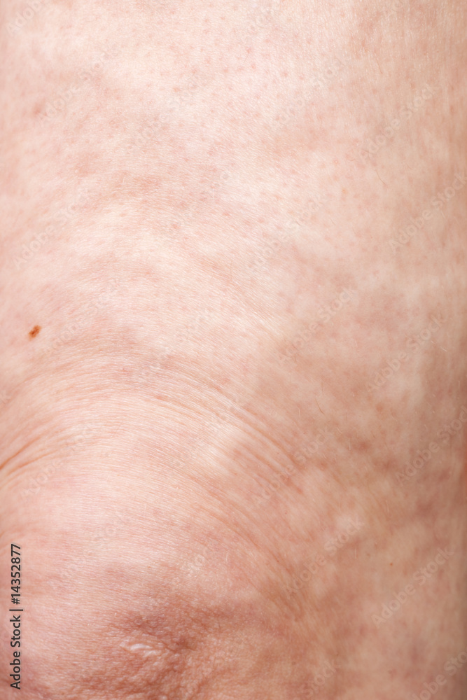 Fototapeta premium woman cellulite