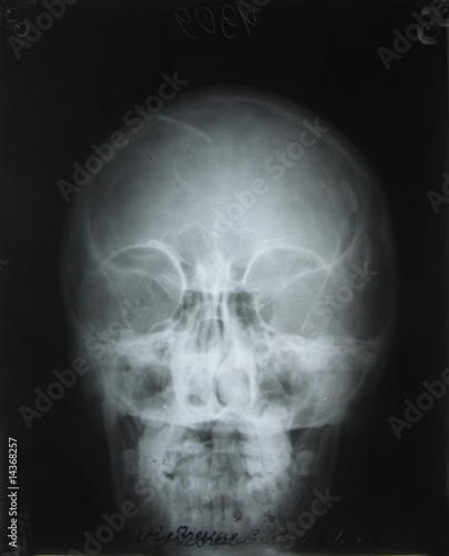 photo of frontal x-ray picture of human skull in natural colors