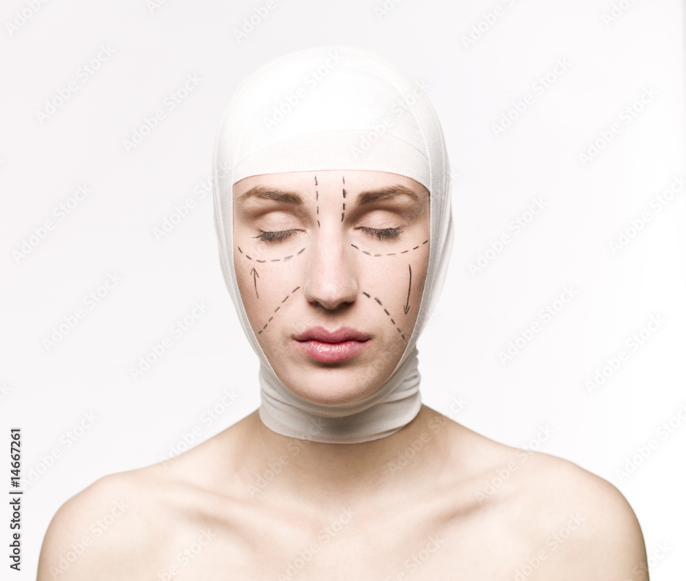 Woman prepared for a plastic surgery Woman prepared for a plastic surgery