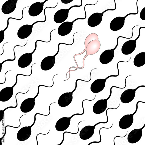Gay sperm