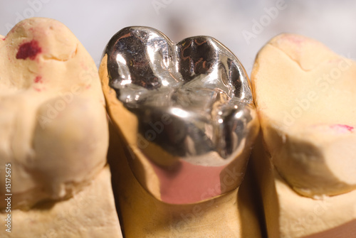 Goldkrone 1
