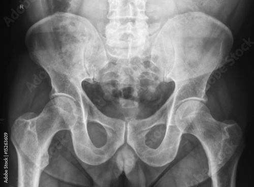 Foto Male pelvis X-Ray