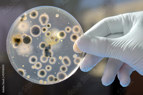 Hand Holds Petri Dish with Bacteria Culture photo