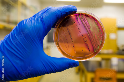 Valokuva Escherichia coli