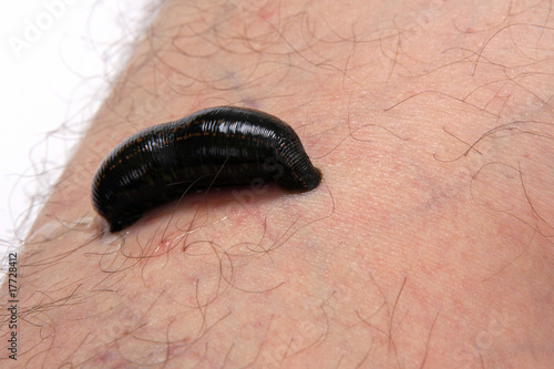 Blood sucking leech on leg.