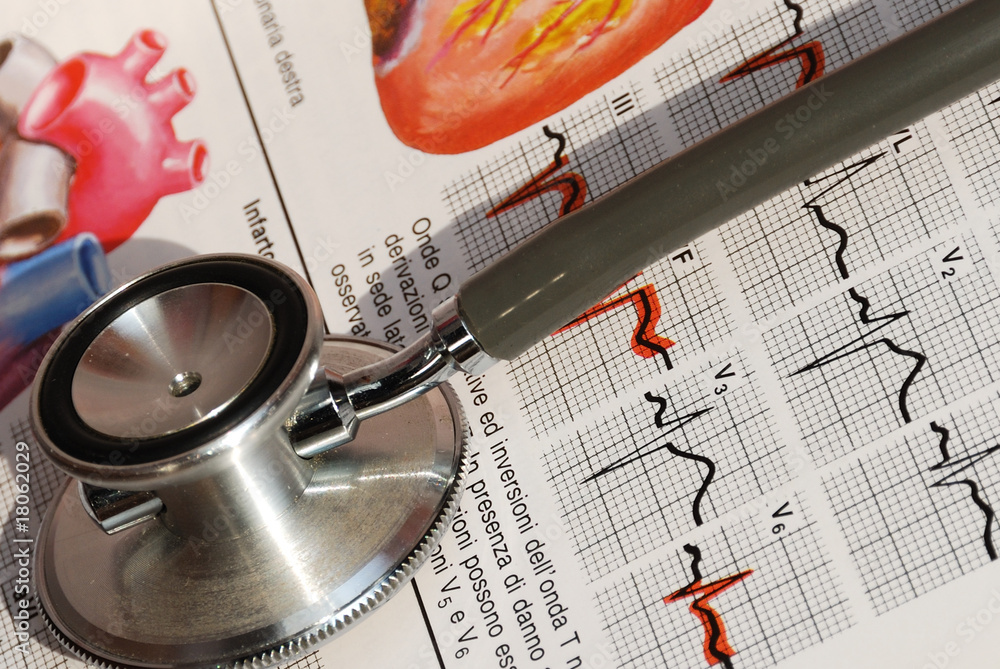 Fonendoscopio StockFoto Adobe Stock