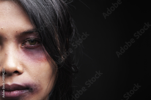 Domestic violence victim photo