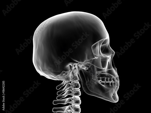 xray human head skull photo