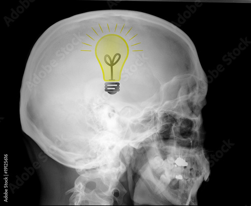 Idéation