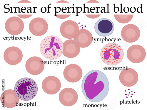 Smear of peripheral blood