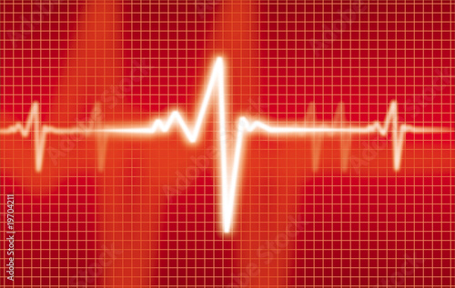 cardiogram