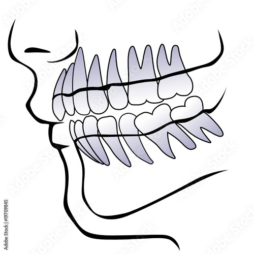 dentatura