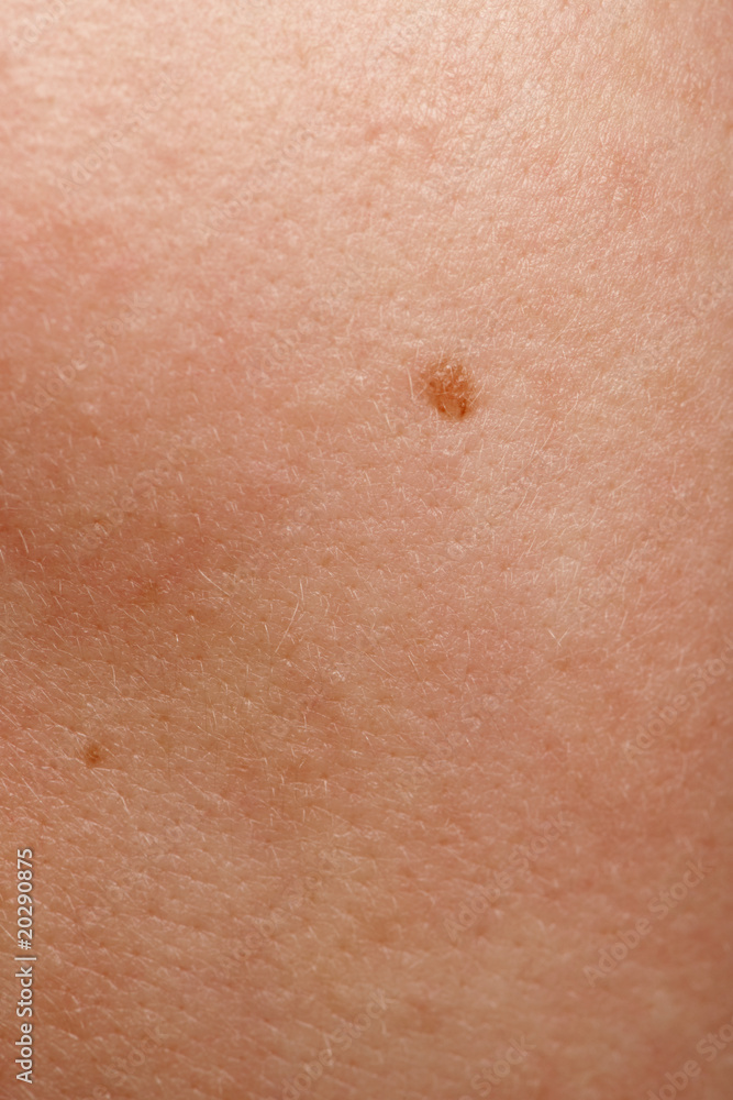 Close-up of human skin and mole
