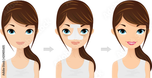 Rhinoplasty Before After