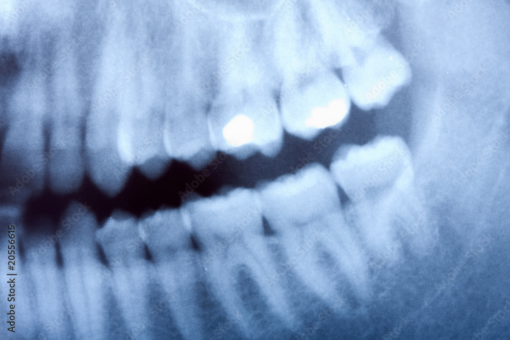 Naklejka premium dental x-ray