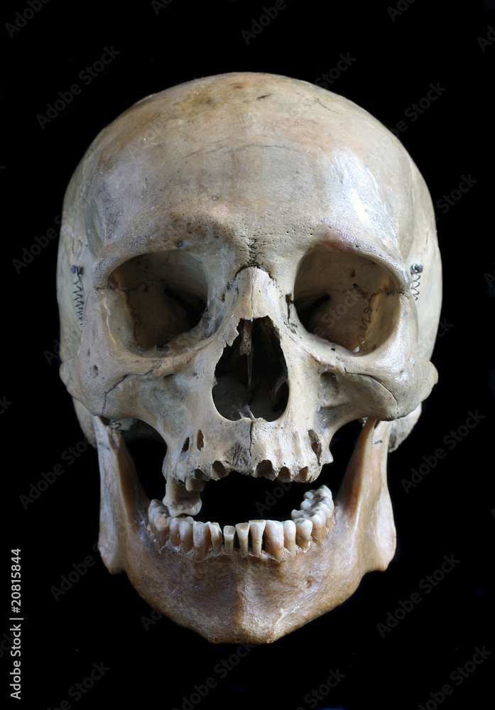Skull of the person Skull of the person