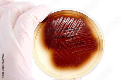 Pathological bacteria Enterococcus Faecalis photo