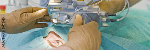 chirurgie réfractive