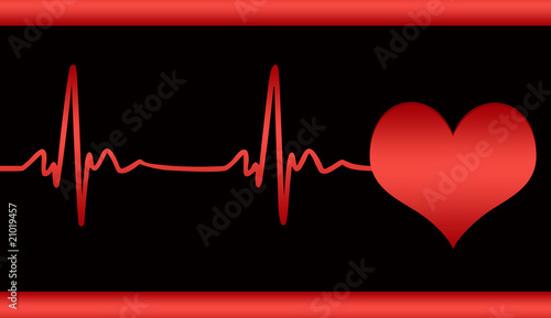 Cardiogram of heart