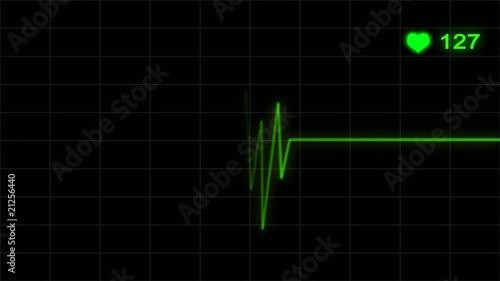 electrocardiograma photo