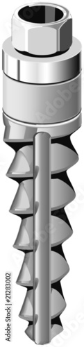 Implantat