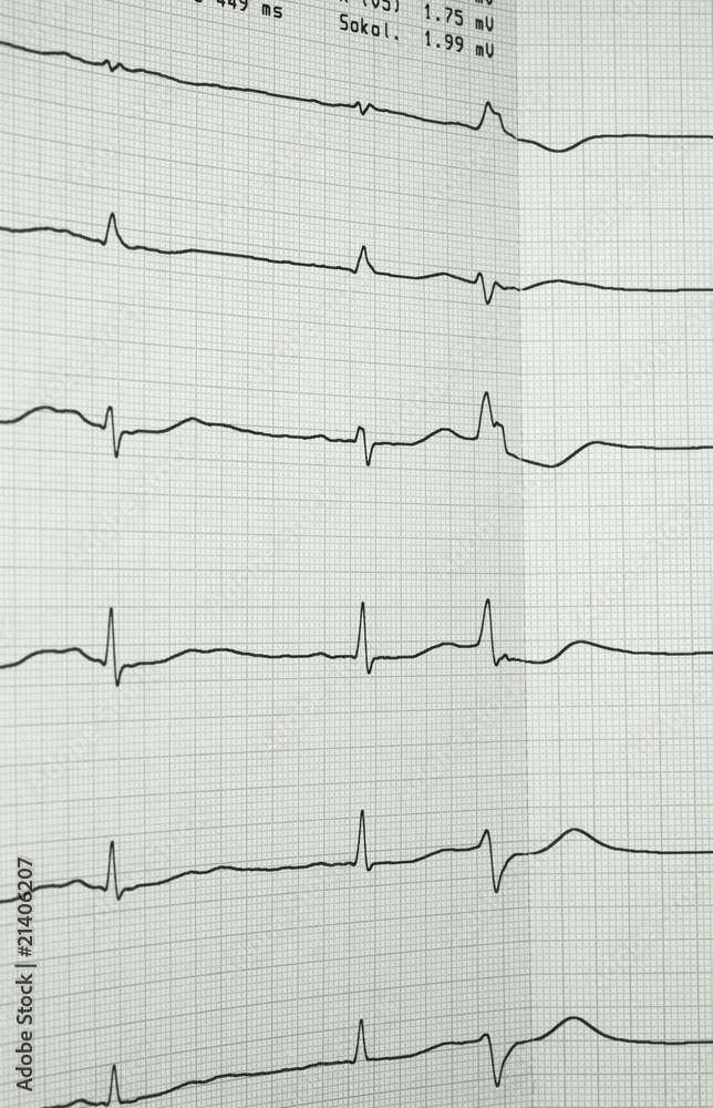 Naklejka premium EKG