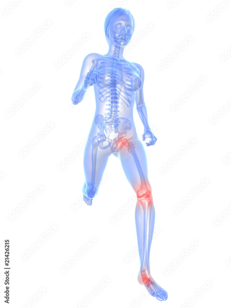 laufendes Skelett mit schmerzendem Knie und Hüftgelenk