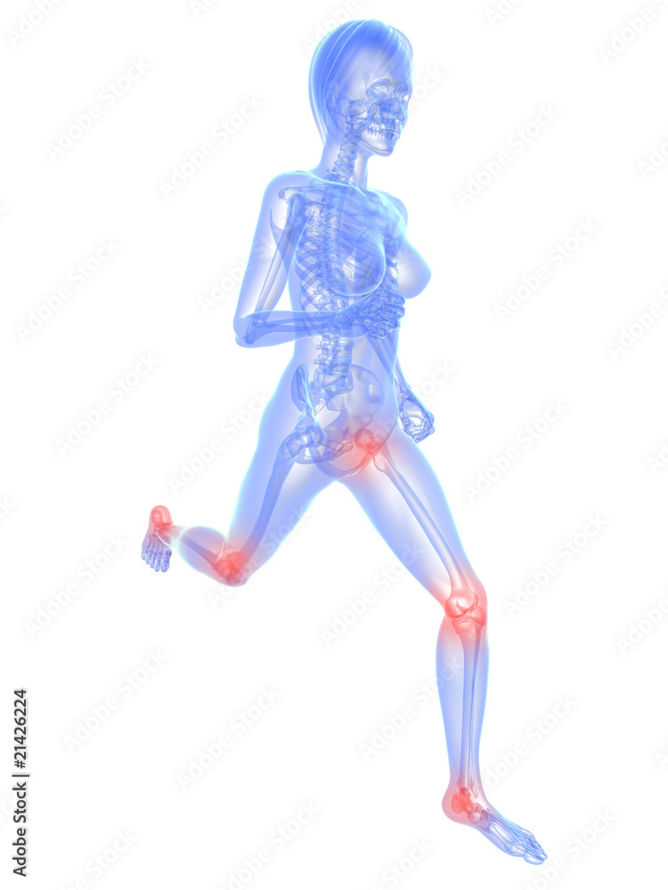 laufendes Skelett mit schmerzendem Knie und Hüftgelenk laufendes Skelett mit schmerzendem Knie und Hüftgelenk