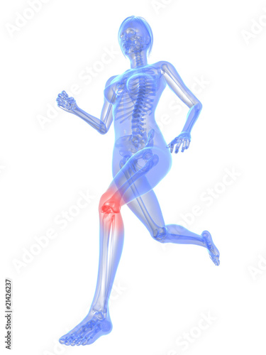 laufendes Skelett mit schmerzendem Kniegelenk © SciePro