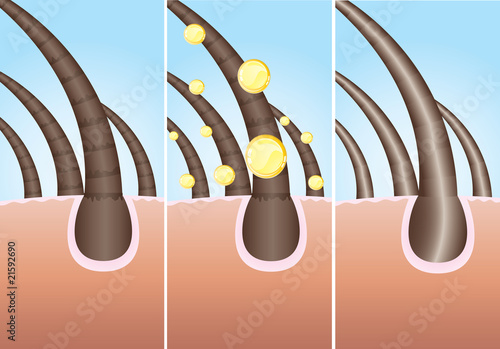 Illustration of three phase of hair cure, vector