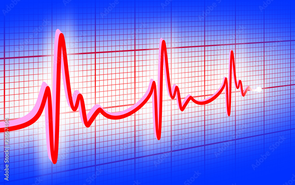 cardiogram cardiogram