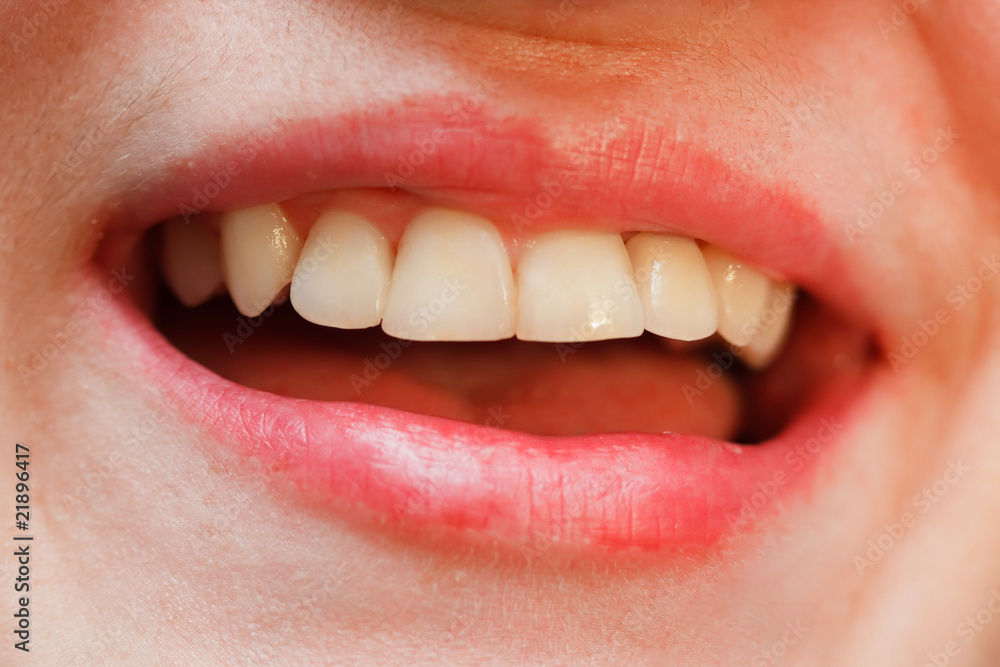 Fototapeta premium Ceramic crown with zirconia base