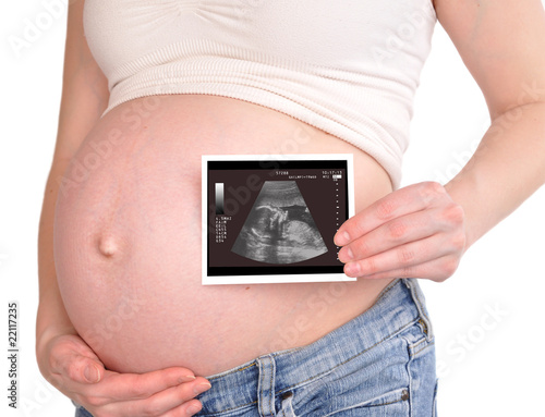 Pregnant Woman Holding Ultrasound Baby to Belly