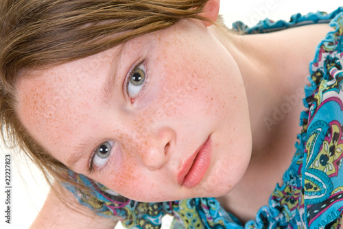 Obraz na plátně Freckle faced girl