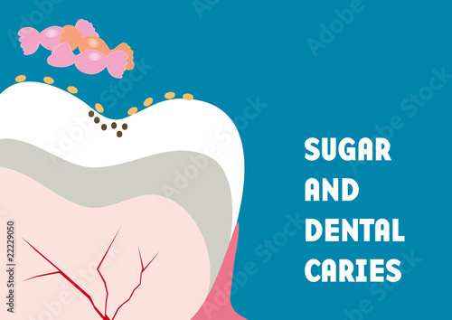 Dental caries