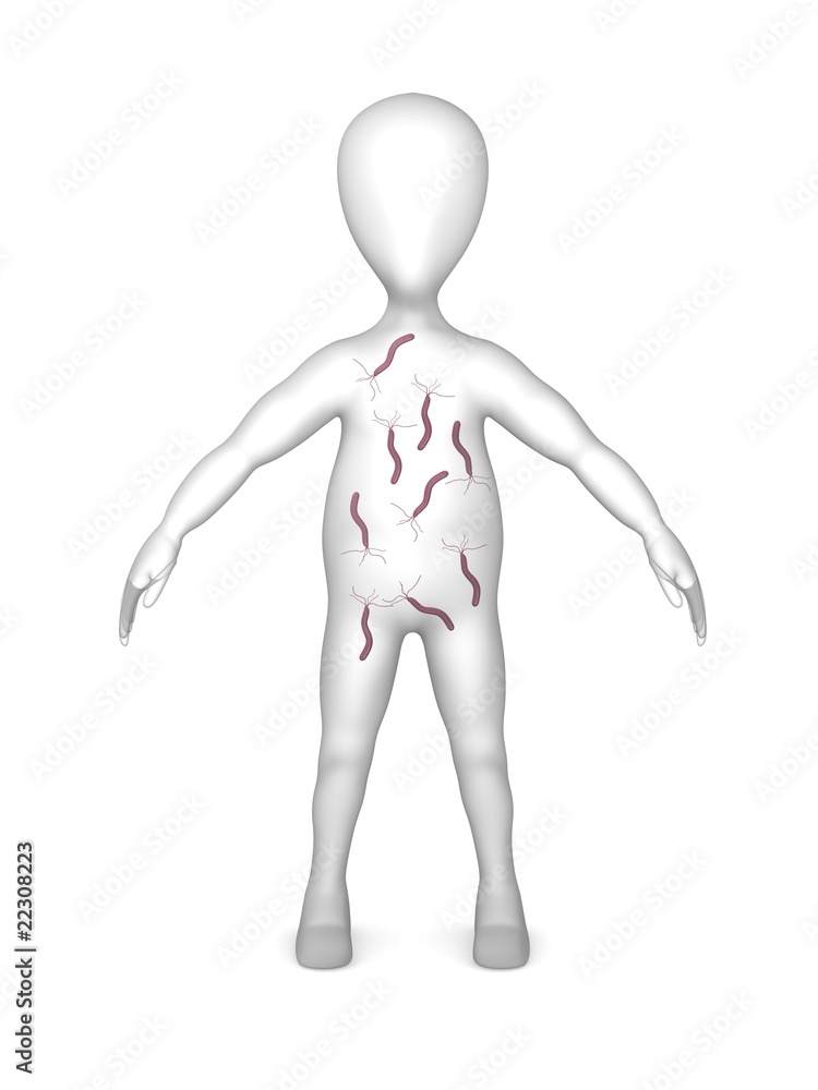 helicobacter helicobacter