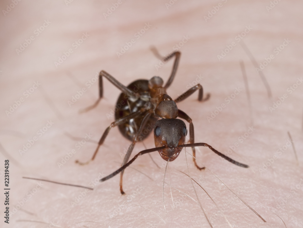 Angry ant biting hair on human hand. Angry ant biting hair on human hand.