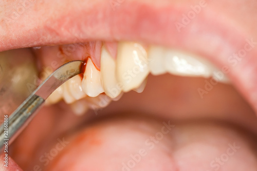 dental treatment photo