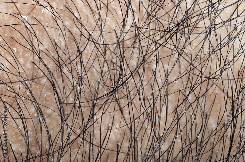 Fototapeta premium Balding