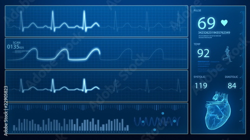 Heart beat monitor - ecg concept in loop photo
