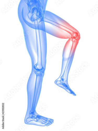 menschliches Skelett - schmerzendes Kniegelenk © Sebastian Kaulitzki