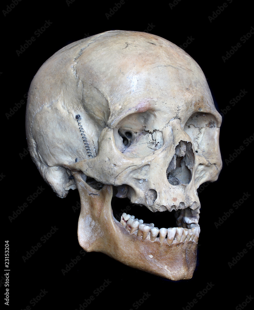 Skull of the person. Skull of the person.
