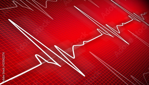 cardiogram