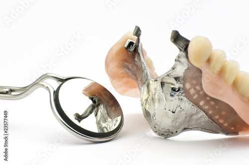 Combined fixed and mobile prosthesis