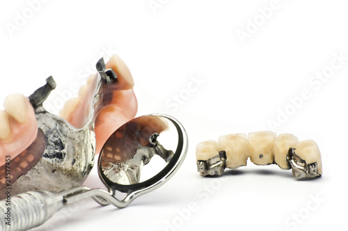 Combined fixed and mobile prosthesis