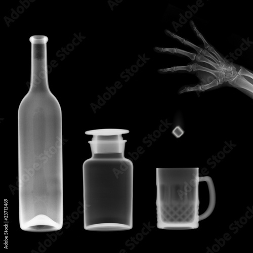 x-ray picture:bottle and mug