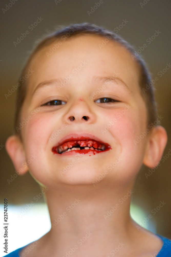 Child with his tooth pulled Child with his tooth pulled