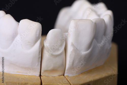 Fototapeta Naklejka Na Ścianę i Meble -  detail dental wax model